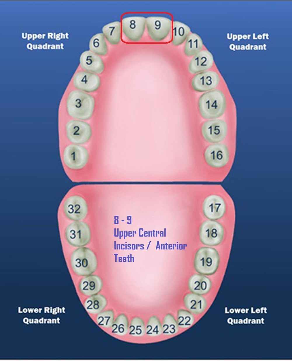DENTAL POLYCARBONATE TEMPORARY CROWNS #103 (ULC) UPPER LEFT CENTRAL 5/PACK