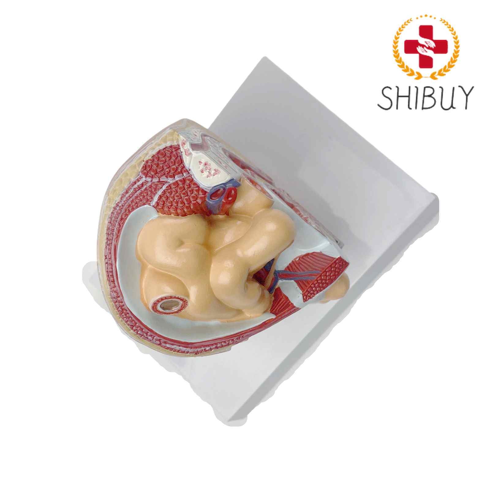 Human Oblique Inguinal Hernia Pathological Skin Model Medical Teaching Models