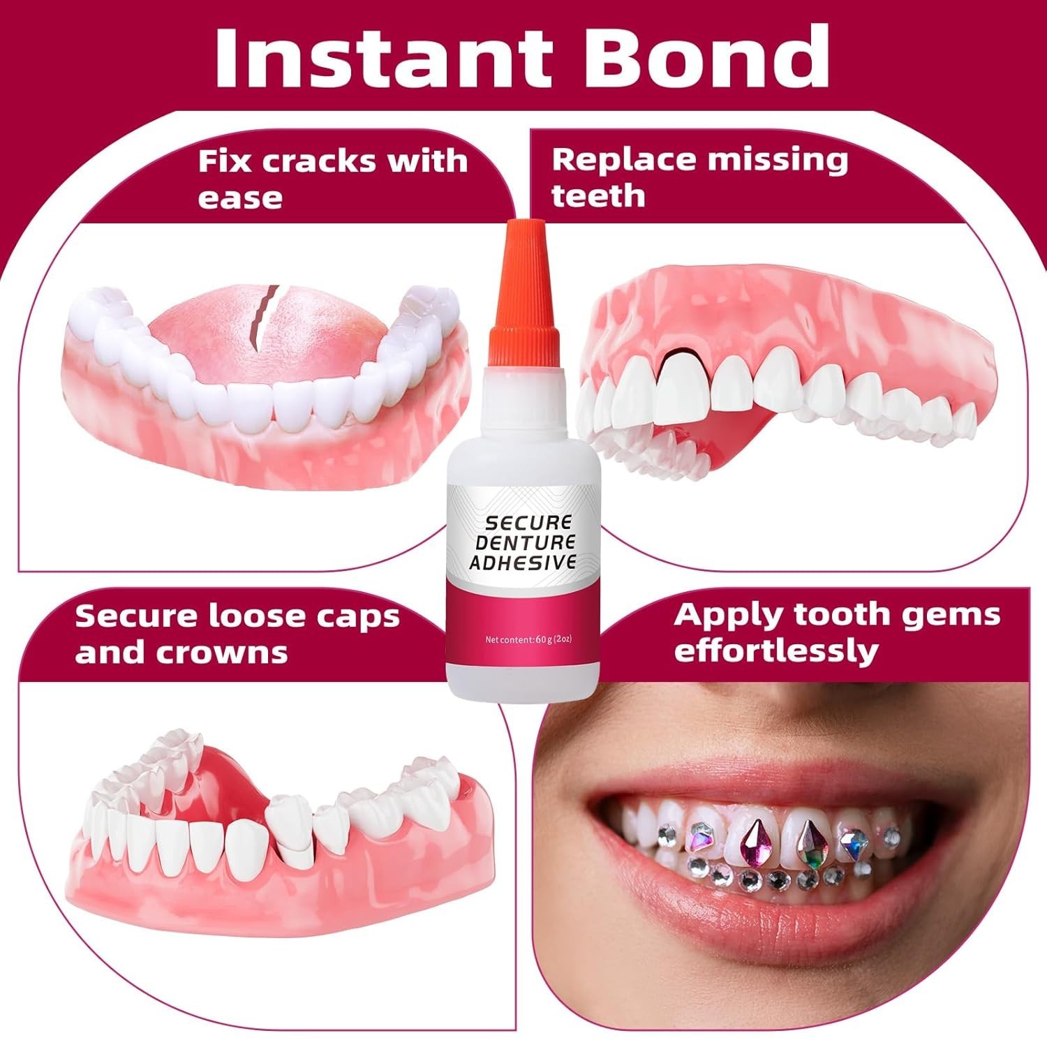 Dental Lab Instant Bonding Dental Glue 1oz, Repair Cracks & Secure Loose Teet…