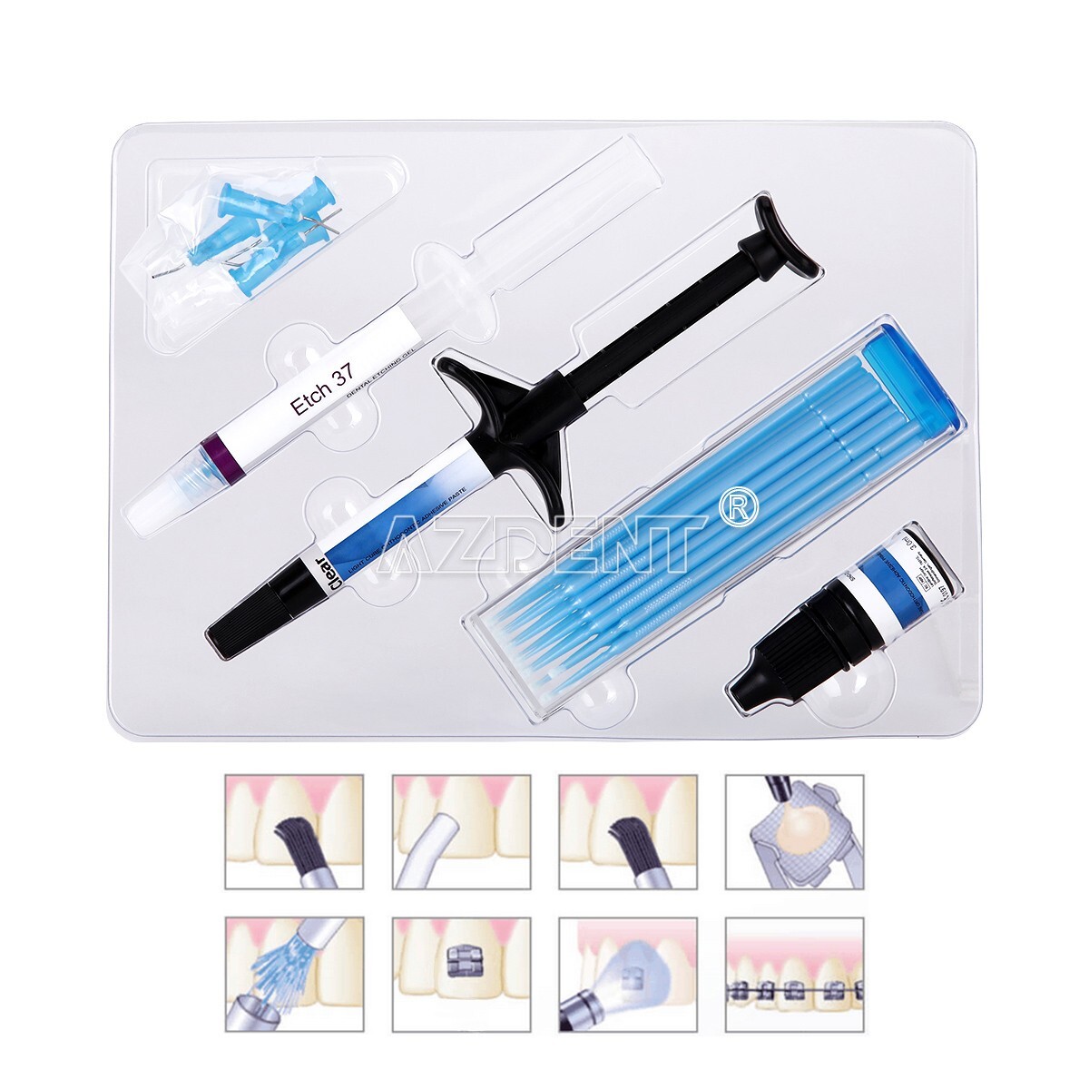 Dentex Dental Orthodontic Bonding Light Cure Adhesive Paste Primer Etchant Kit