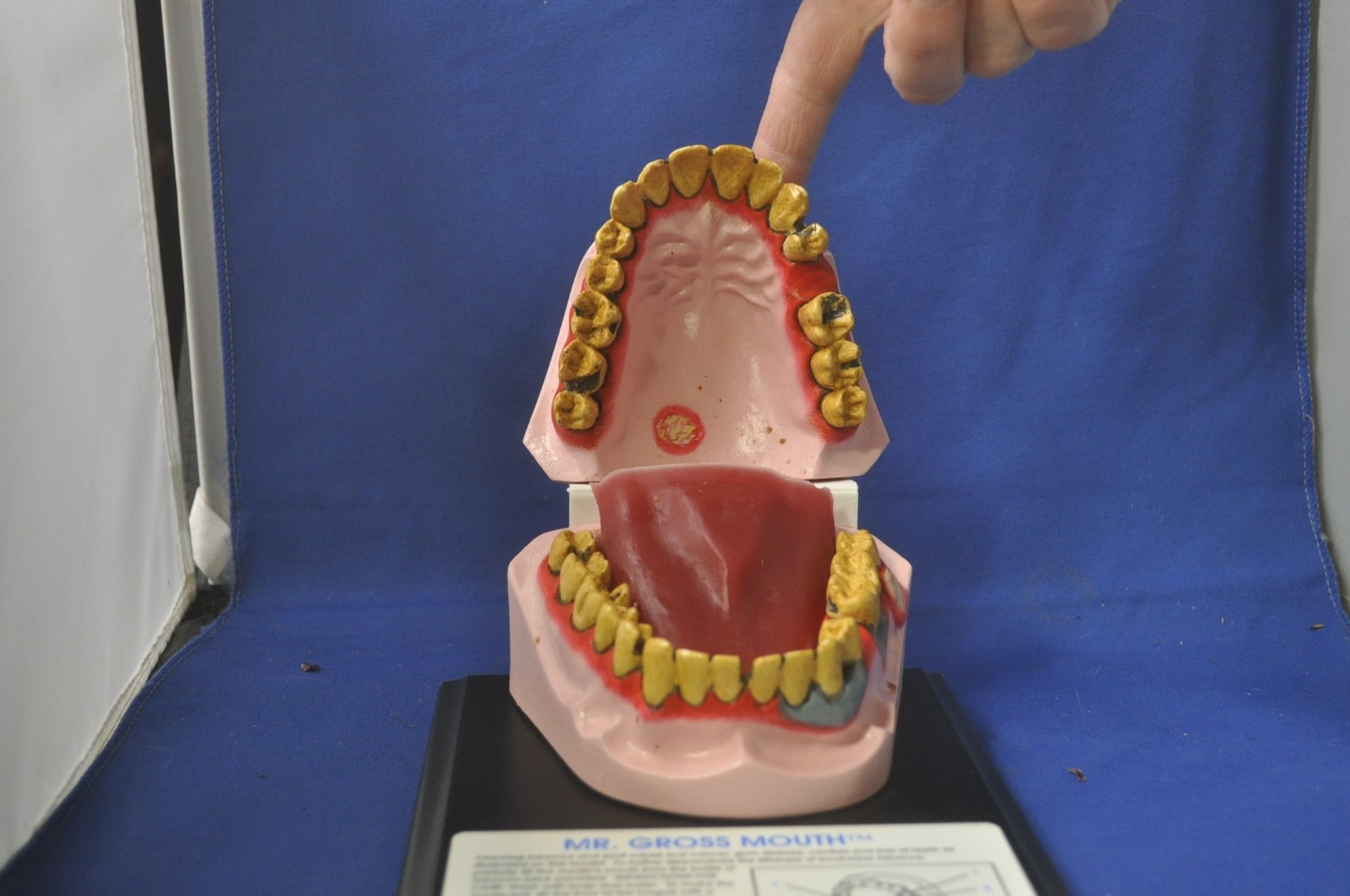 Health Edco Mr. Gross Mouth Dental Display With Case