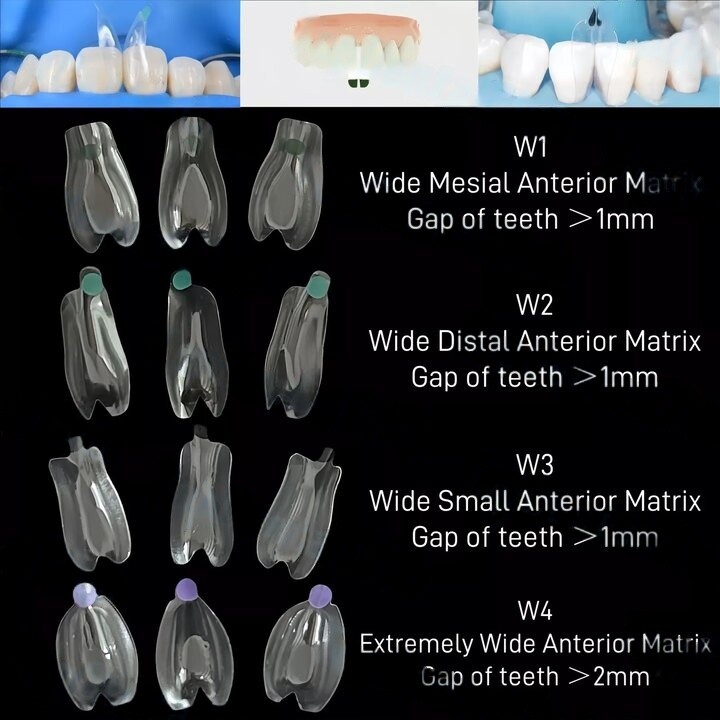 Dental Blue View Strip Anterior Restoration Strips Composite BT Clear Matrix