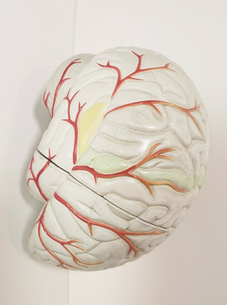 Human Brain Anatomical Teaching Model Life Size Medical Science Cross 4 Sections