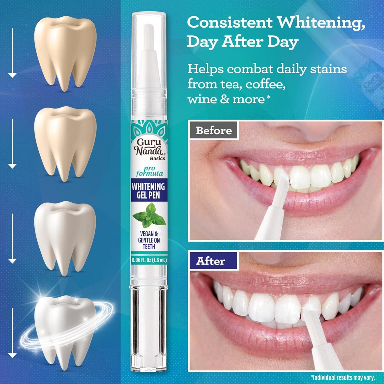 GuruNanda Teeth Whitening Pen,(0.06 fl oz)-20 0.06 Fl Oz (Pack of 1), White