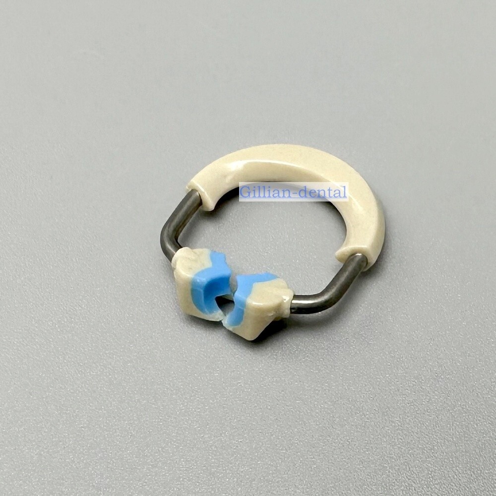 Dental Ortho Sectional Matrix System Nickel Titanium Alloy Matrices Clip Ring