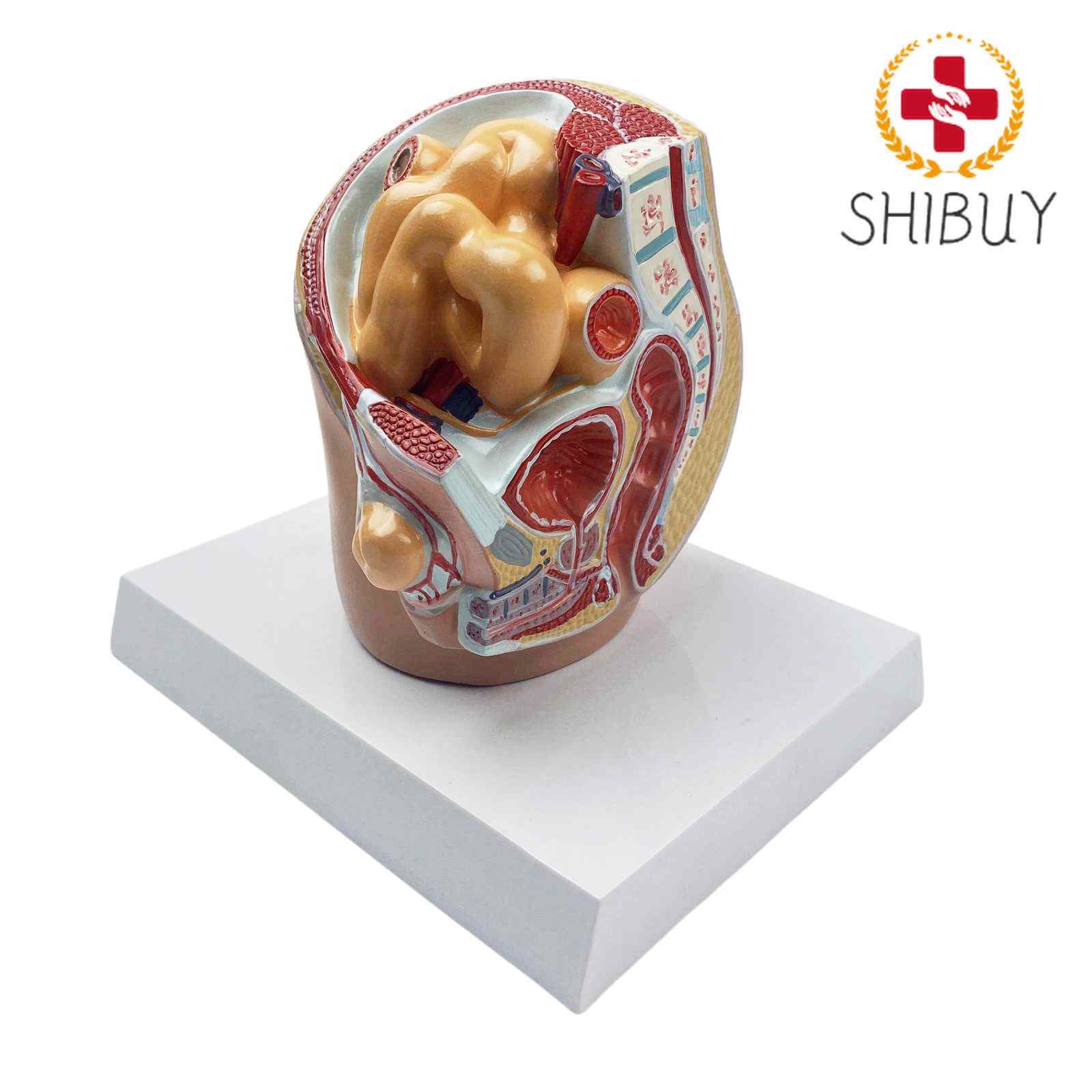 Human Oblique Inguinal Hernia Pathological Skin Model Medical Teaching Models