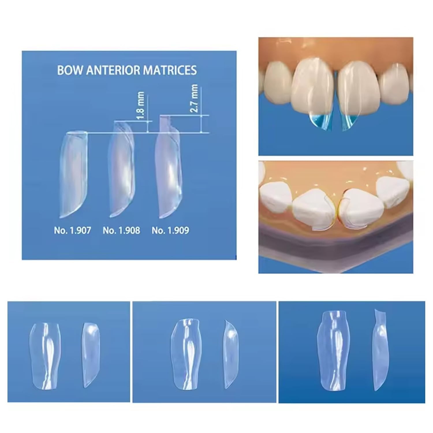 Dental Proximal Anterior Strips Polyester Matrix Bands Clear Matrices Anterior