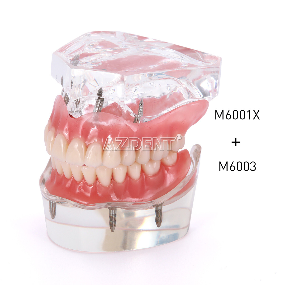 Dental Overdenture Implant Teeth Model Denture with implant Demonstration Clear