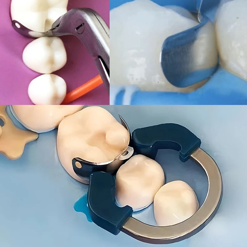 Dental Matrix Band Ring NITI Sectional Matrice Clamp Ring Fit Palodent V3 System