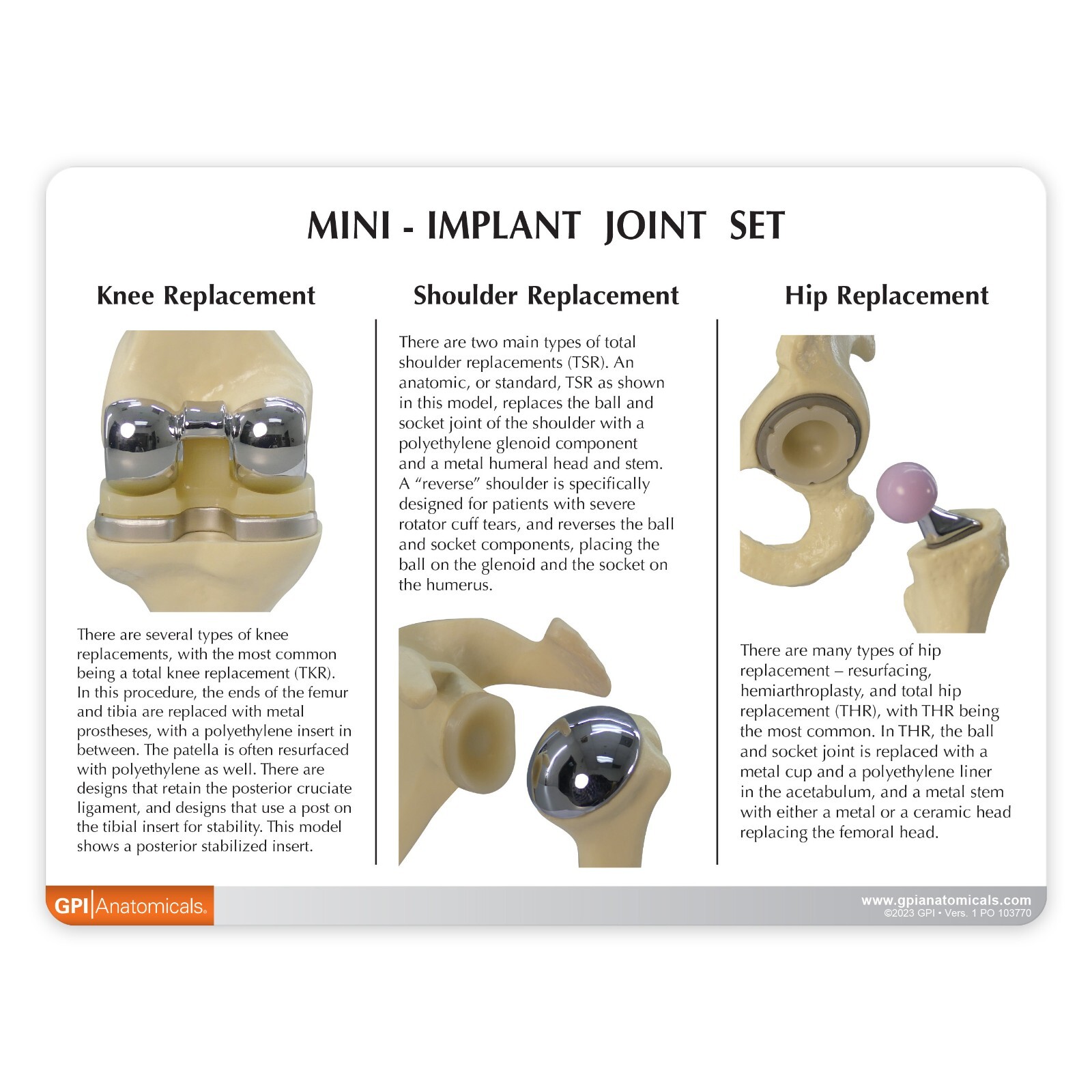 Implant Mini-Implant Joint Set of 3 GPI LFA #1910. Make Us an Offer! SEE VIDEO