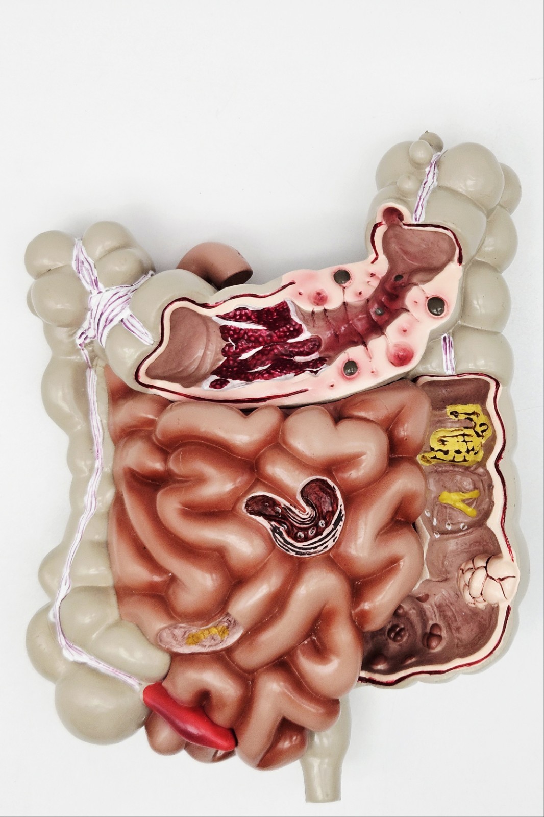GI Tract Anatomy Model Handpainted Medical Display Gastro Intestinal Display