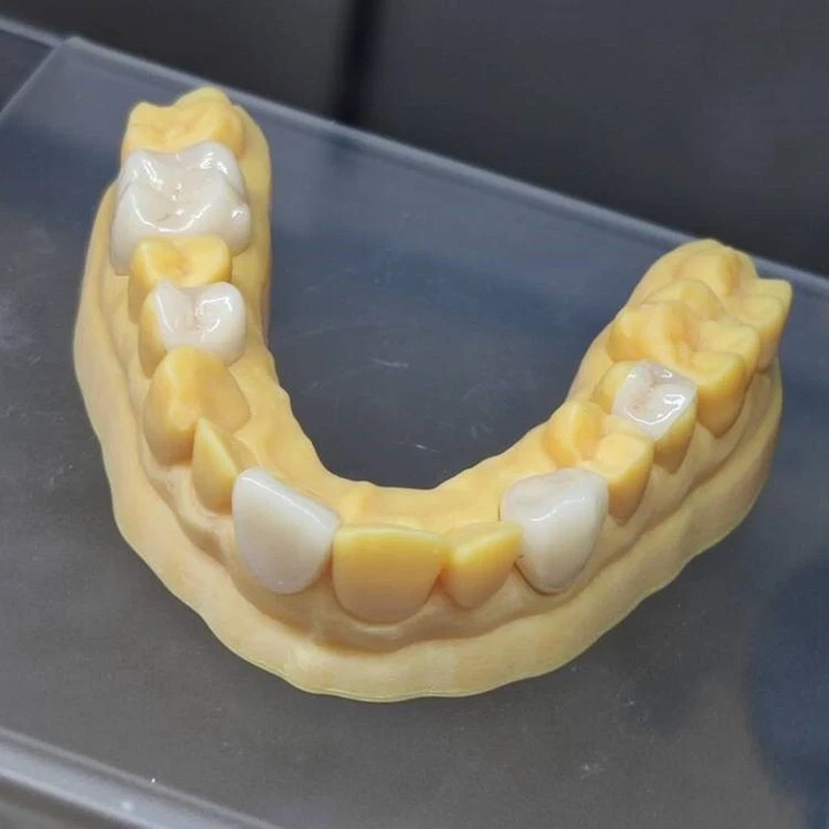C14 Dental Emax Ceramic Blocks Lithium Disilicate CAD/CAM CEREC Block 5pcs A1 A3
