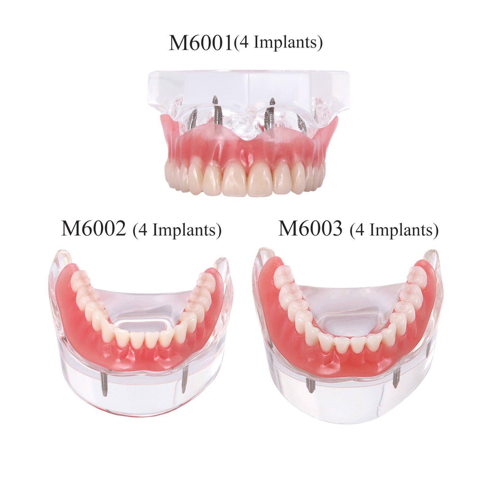 Dental Typodont Teeth Model Ortho Implant Pathological Perio Practice Demo Model