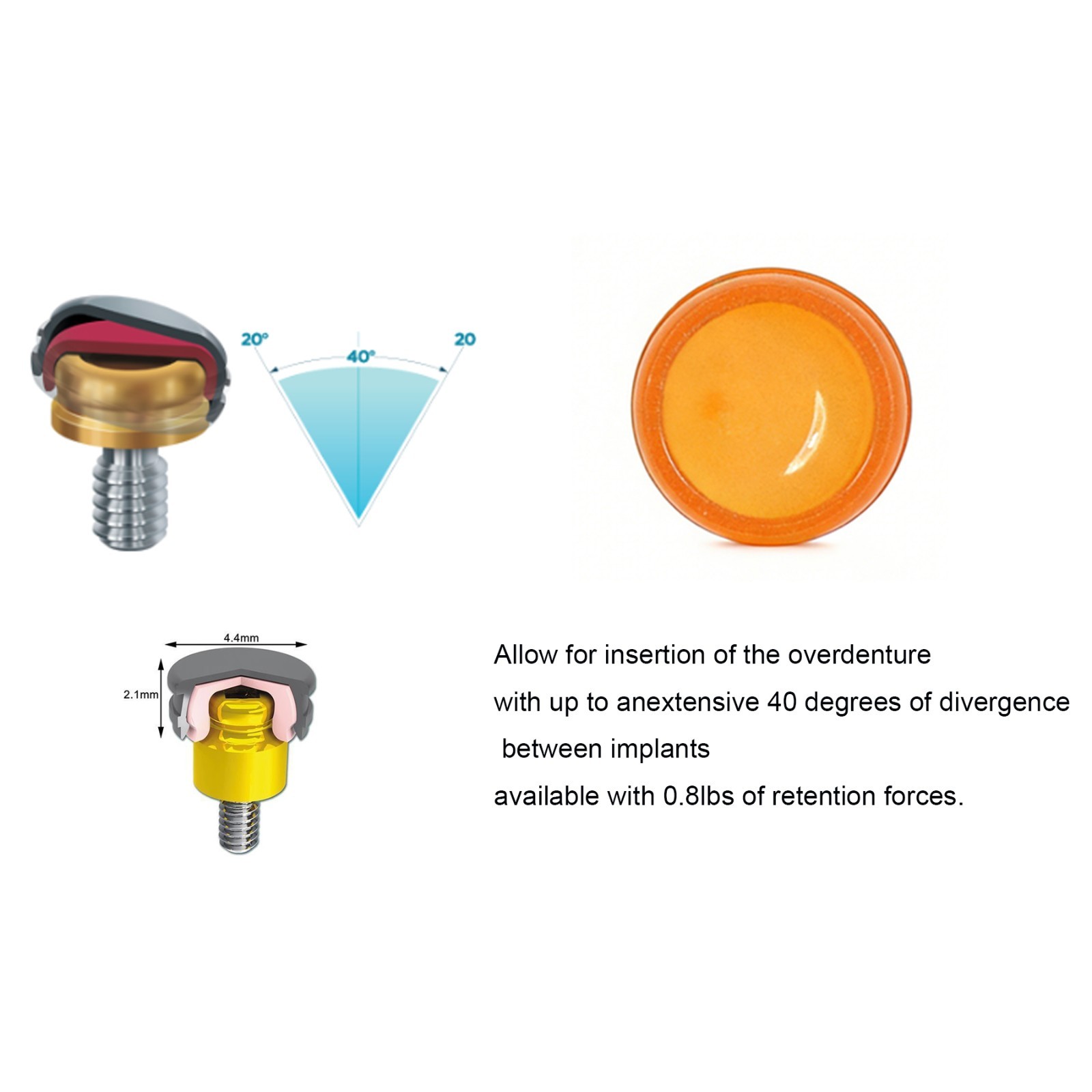 US Locator Extended Standard Range Inserts Retention cap For zest overdenture