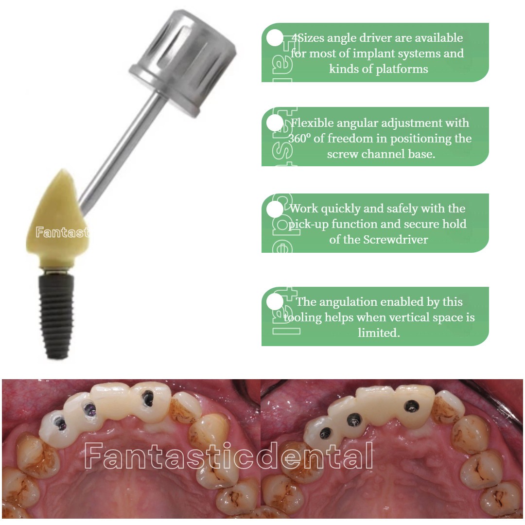 Dental Angled Solutions (AS) Screwdriver Implant Fit Straumann Angulated Channel