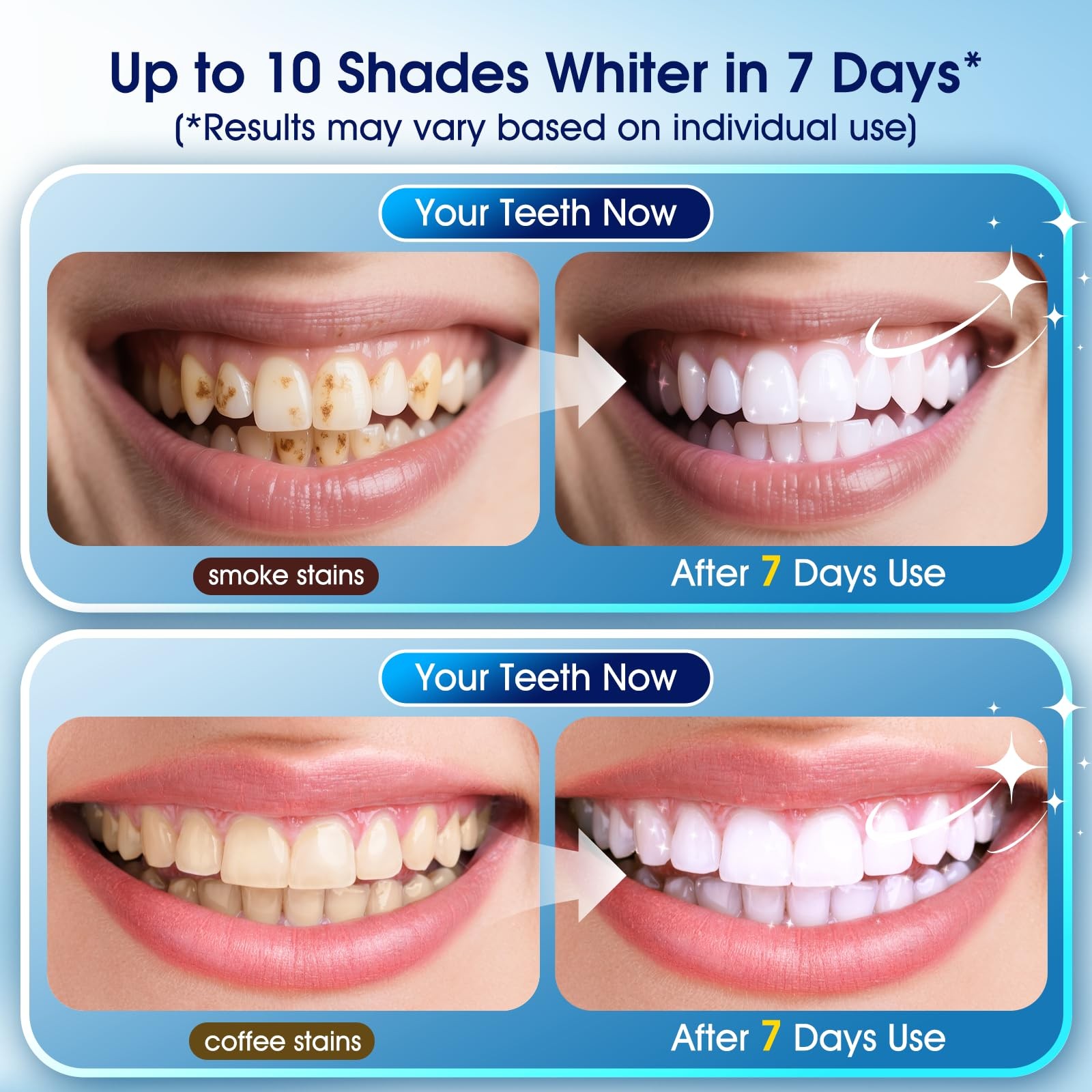 Teeth Whitening Kit with LED Light – 3 0.68 Fl Oz (Pack of 1), White