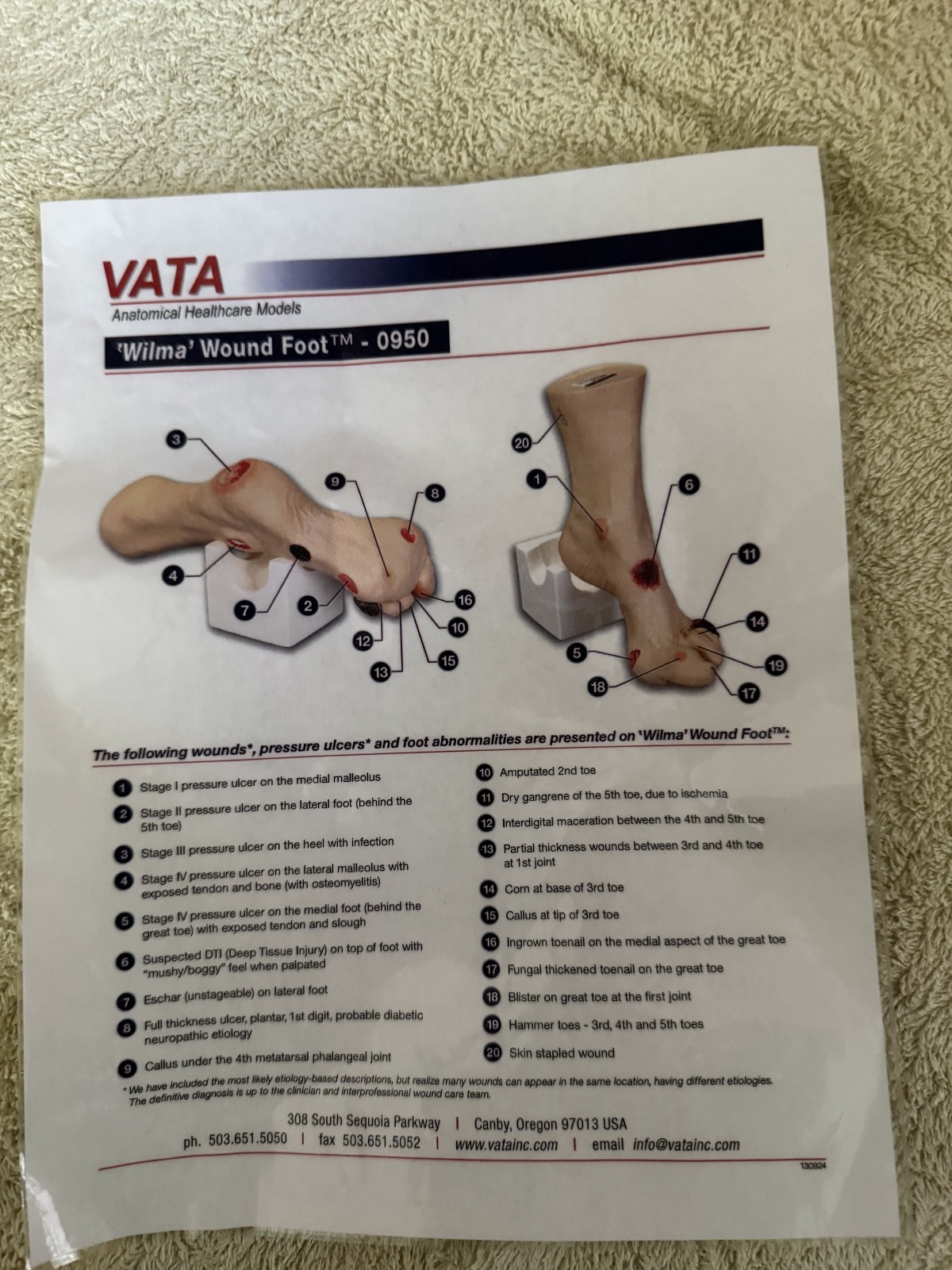 VATA Wilma Wound Foot Teaching Model
