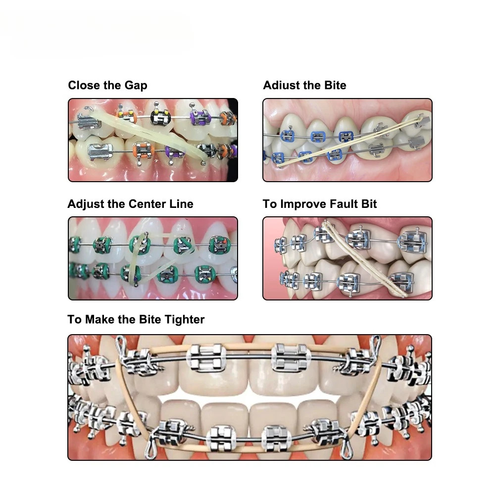 5000pcs Dental Ortho Elastic Rubber Bands 3.5/5.0/6.5 OZ Latex Braces Zoo Pack
