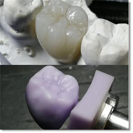 C14 Dental Lithium Disilicate Glass Ceramic Block LT CAD/CAM CEREC Emax 5Pcs/Box