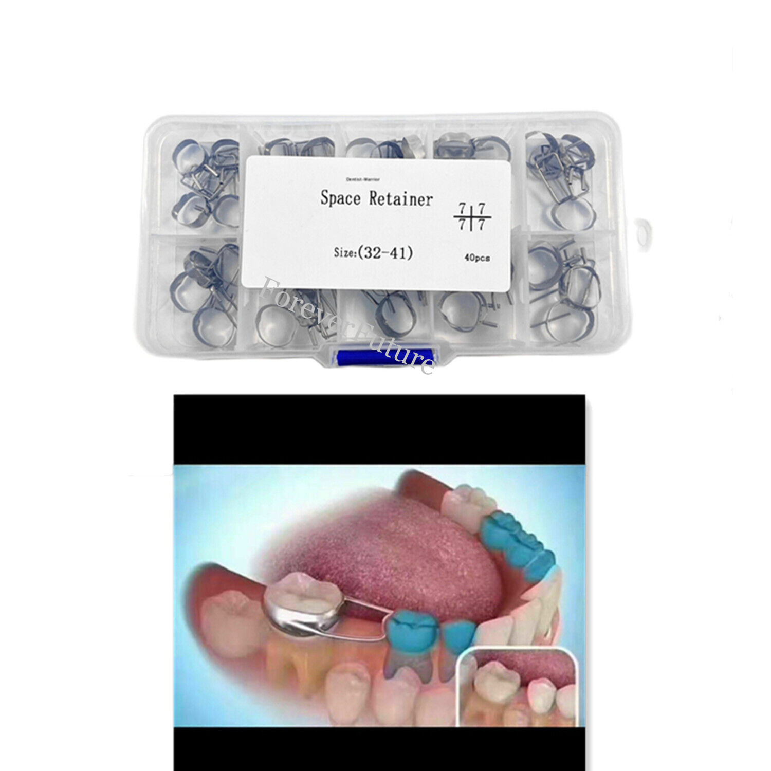 1-10Box Dental Teeth Brace Preformed Space Maintainer Retainer Molar Bands 2nd