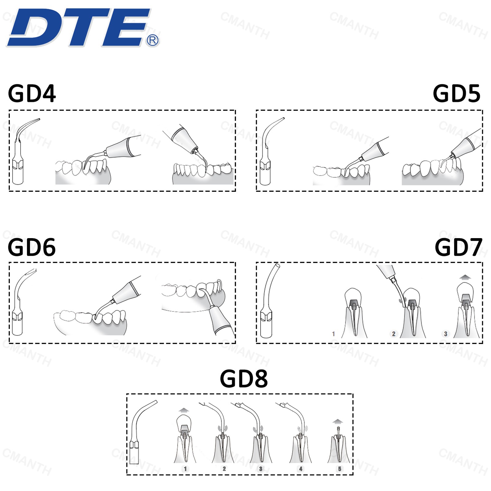 Woodpecker DTE Dental Ultrasonic Scaler Tips GD-Series Fit SATELEC ACTEON NSK