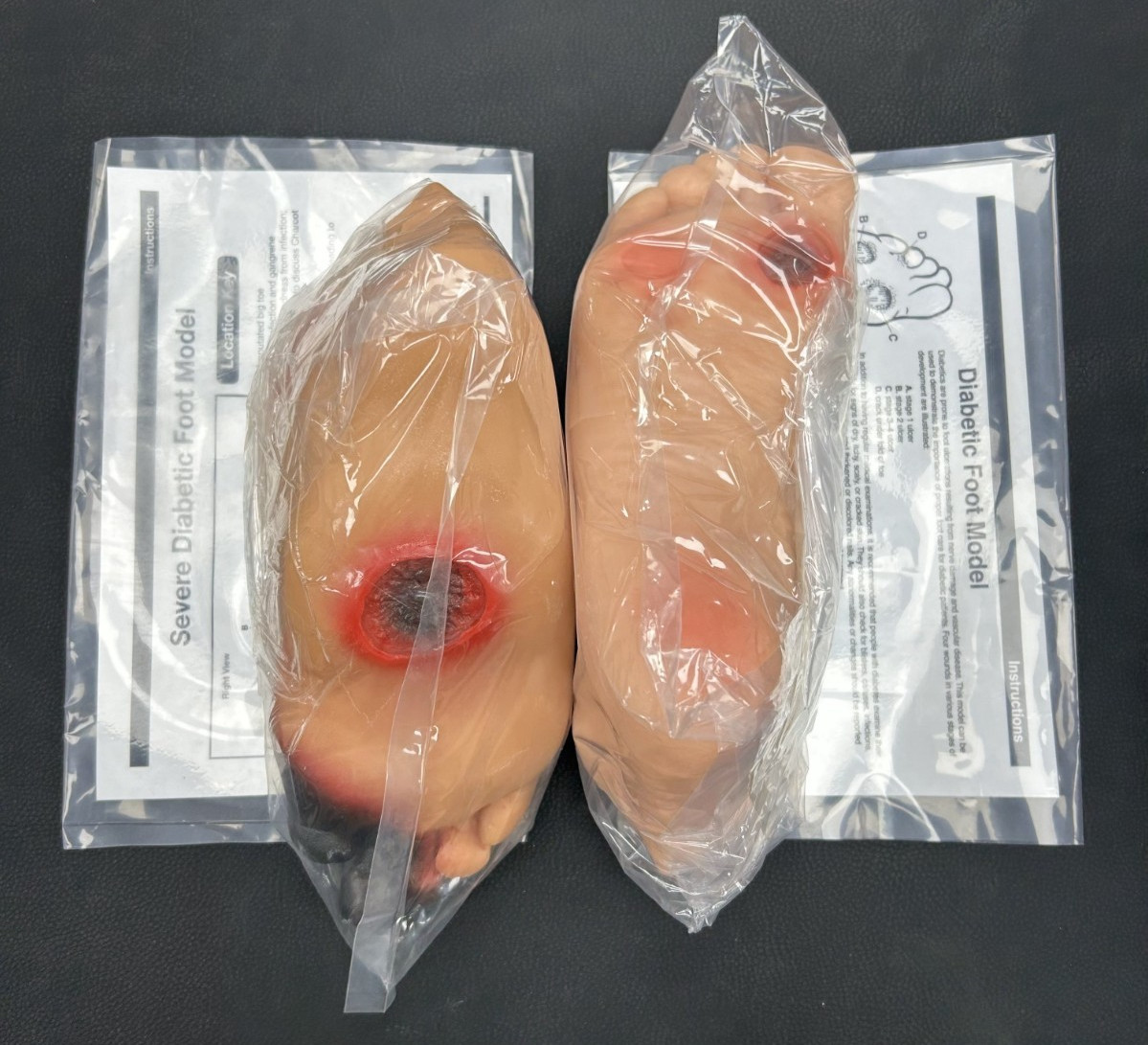 Diabetic Foot Model Set (Severe)