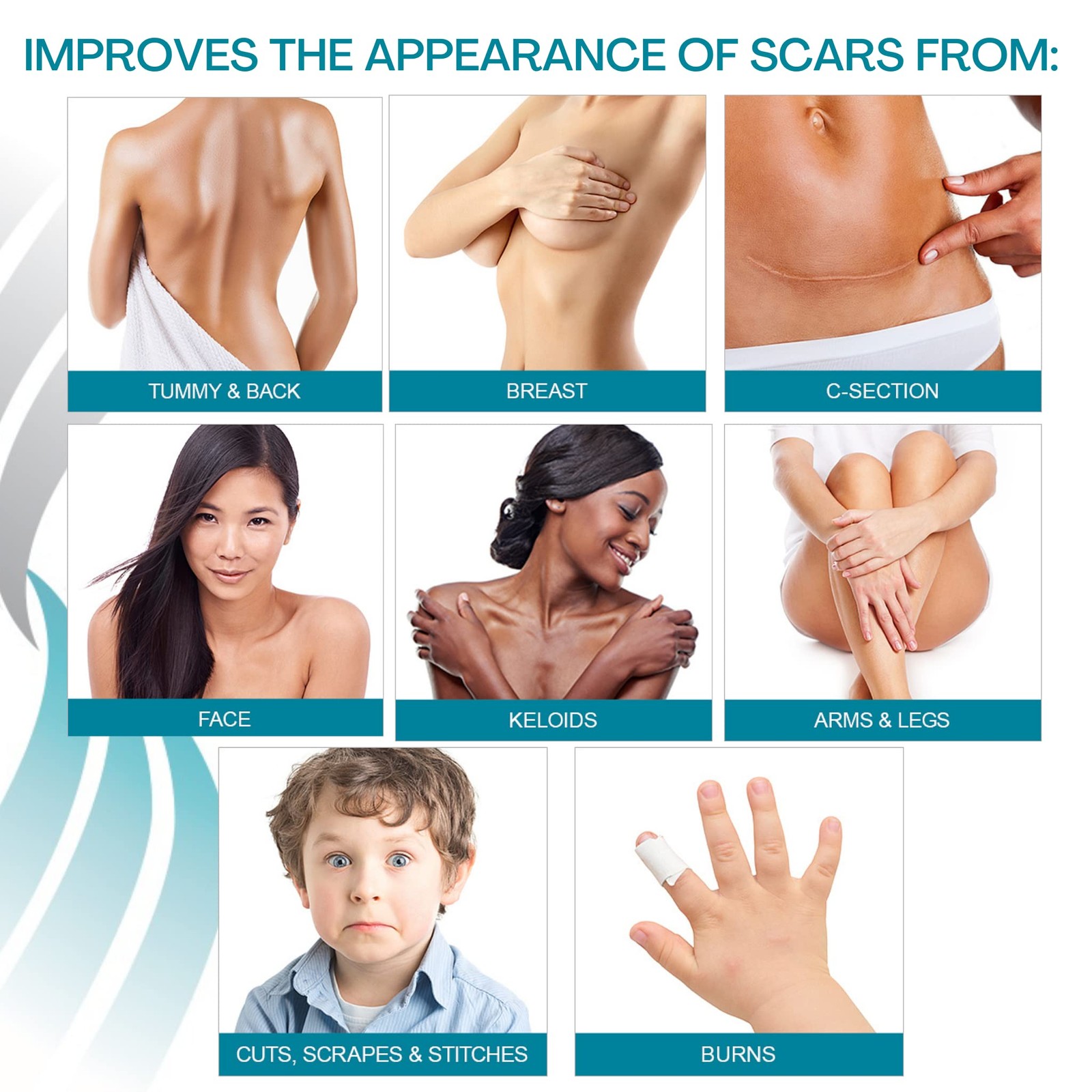 Newgel Advanced Silicone Professional Scar Sheets By Mynewgel Sheeting Set