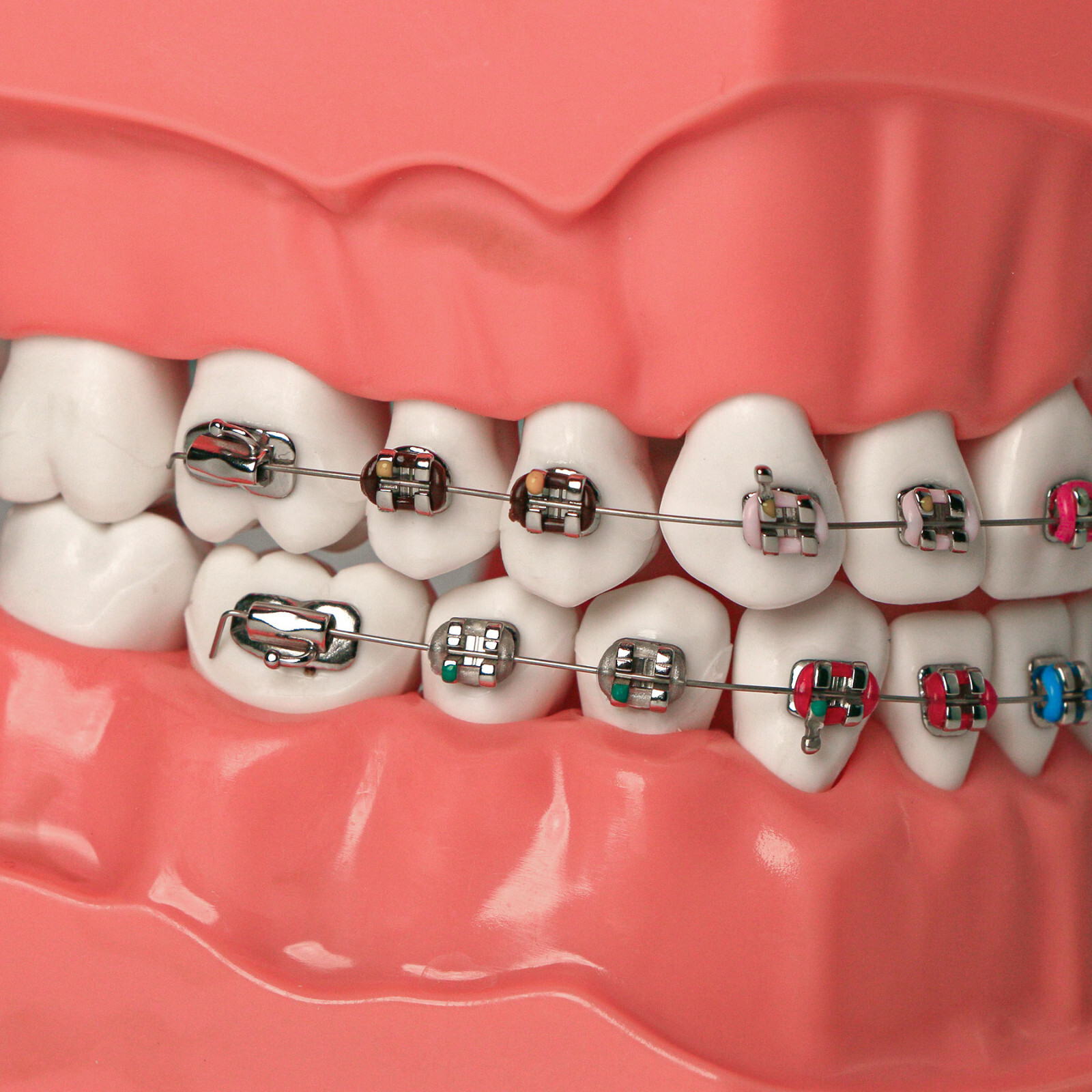 US Dental 1:1 TypodontTeeth Model Orthodontic with Metal Brackets Brace M7010-2
