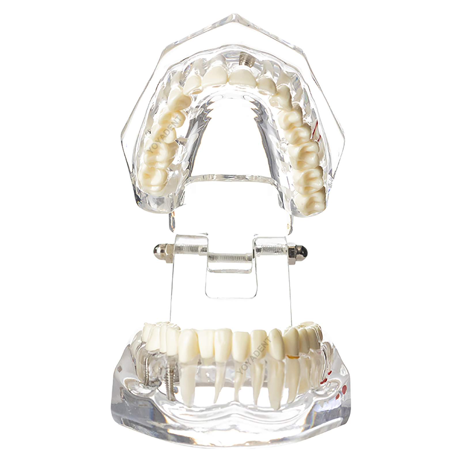 US Dental Teeth Model Ortho Implant Practice Teaching With Implants Demo Model