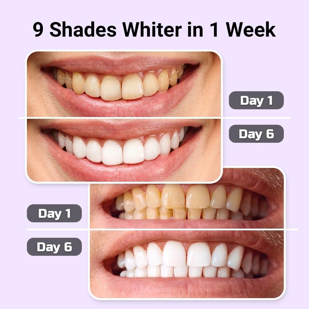 Puur Smile Teeth Whitening Kit – LED Light & 8 Ounce (Pack of 1), Multicolor