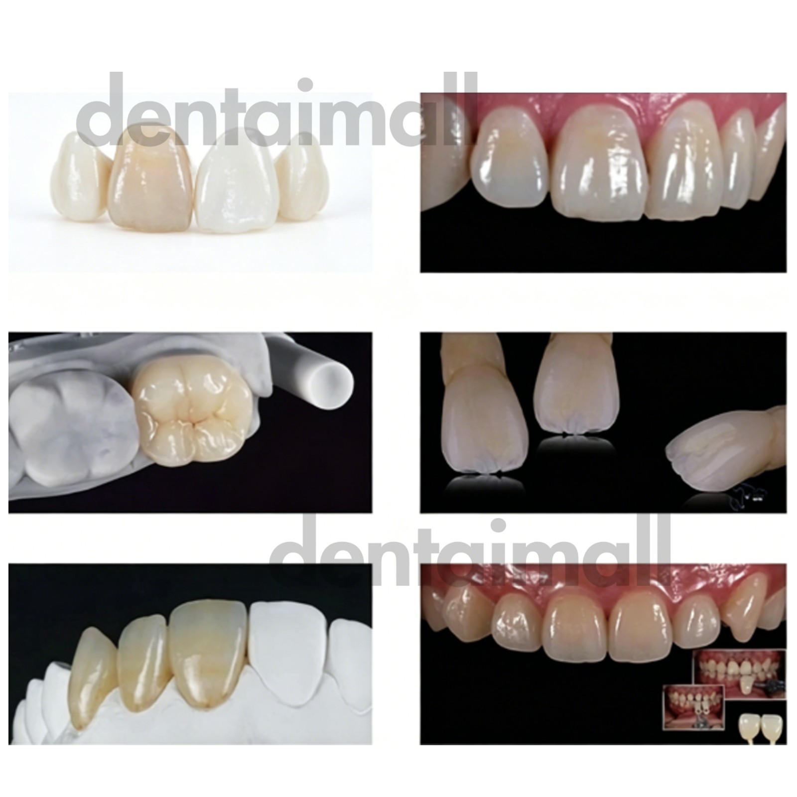 C14LT CEREC Dental Emax Glass Ceramic Blocks Lithium Disilicate CAD/CAM 5Pcs/Box