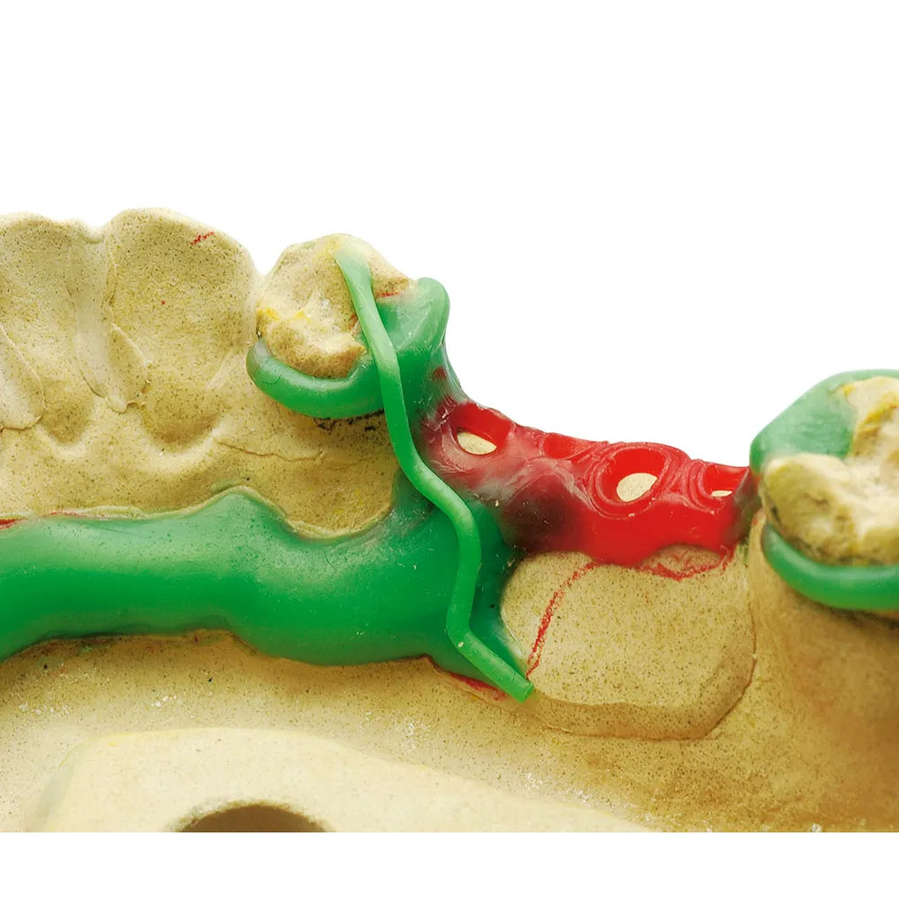Maarc Clasp Profile Base Waxes Dental Wax Partial Denture Prosthetics Free Ship.