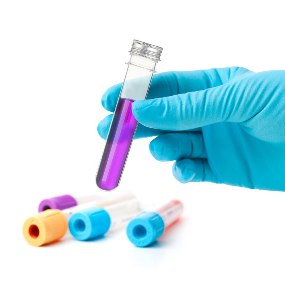 20pcs test tubes plastic test tubes for halloween test tubes with screw caps