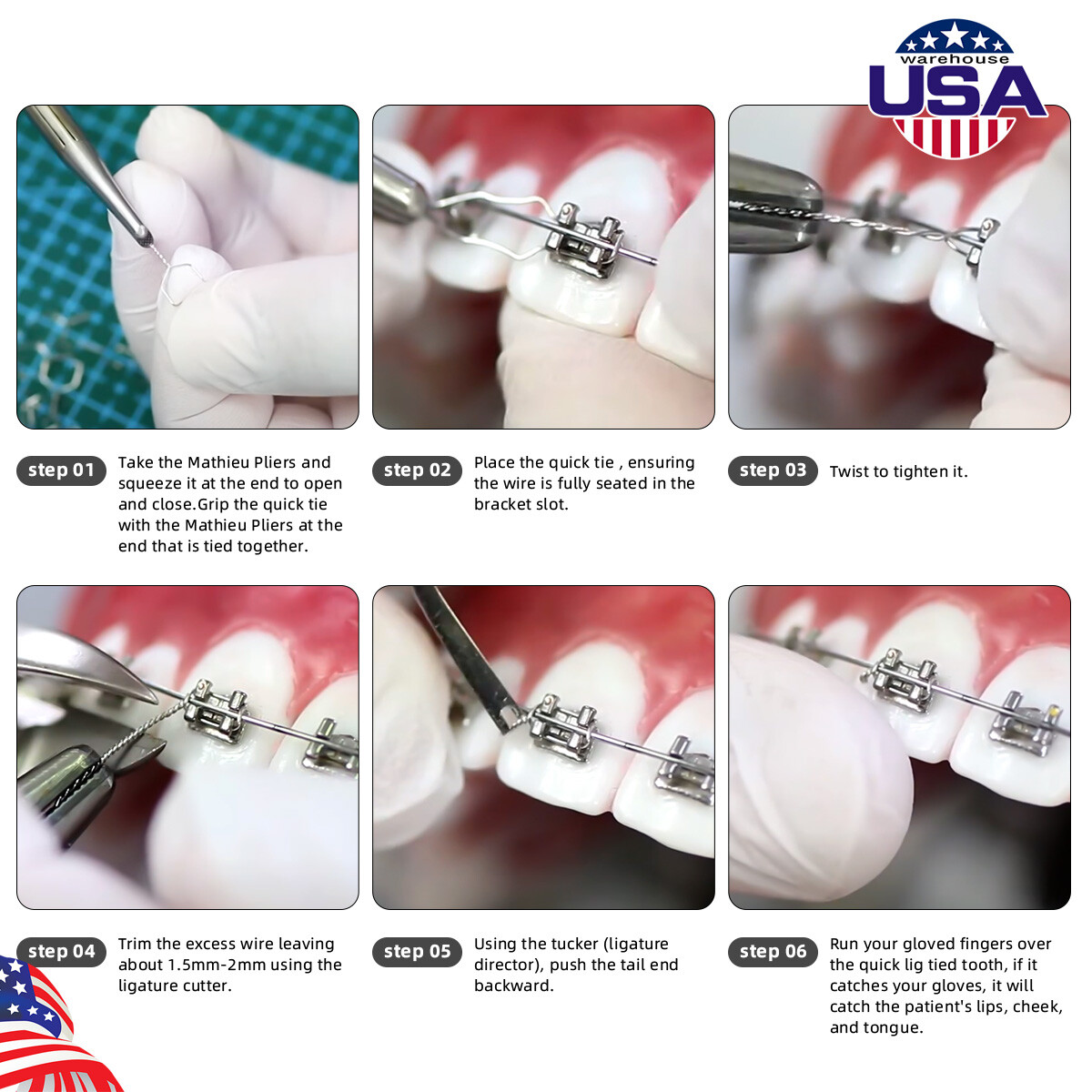 Dental Ortho Wire Preformed Kobayashi Ligature Ties Long Short Twist 100pcs/Pack