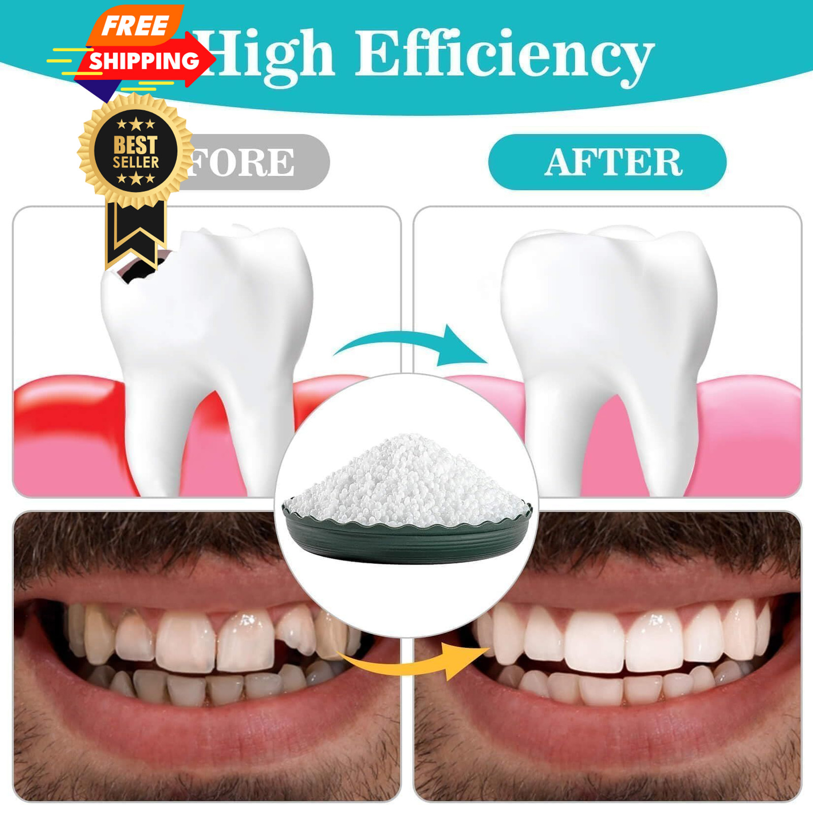 Sukh 10.9oz Moldable False Teeth Beads – Tooth Repair Kit,Repair Small, White