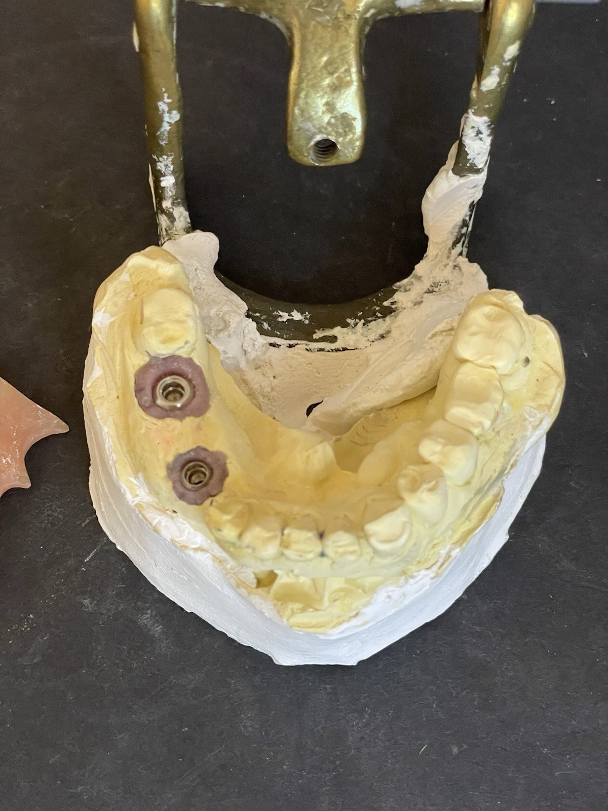 Dental Articulator Implant Case Medical Oddity Macabre Curiosity Halloween Prop