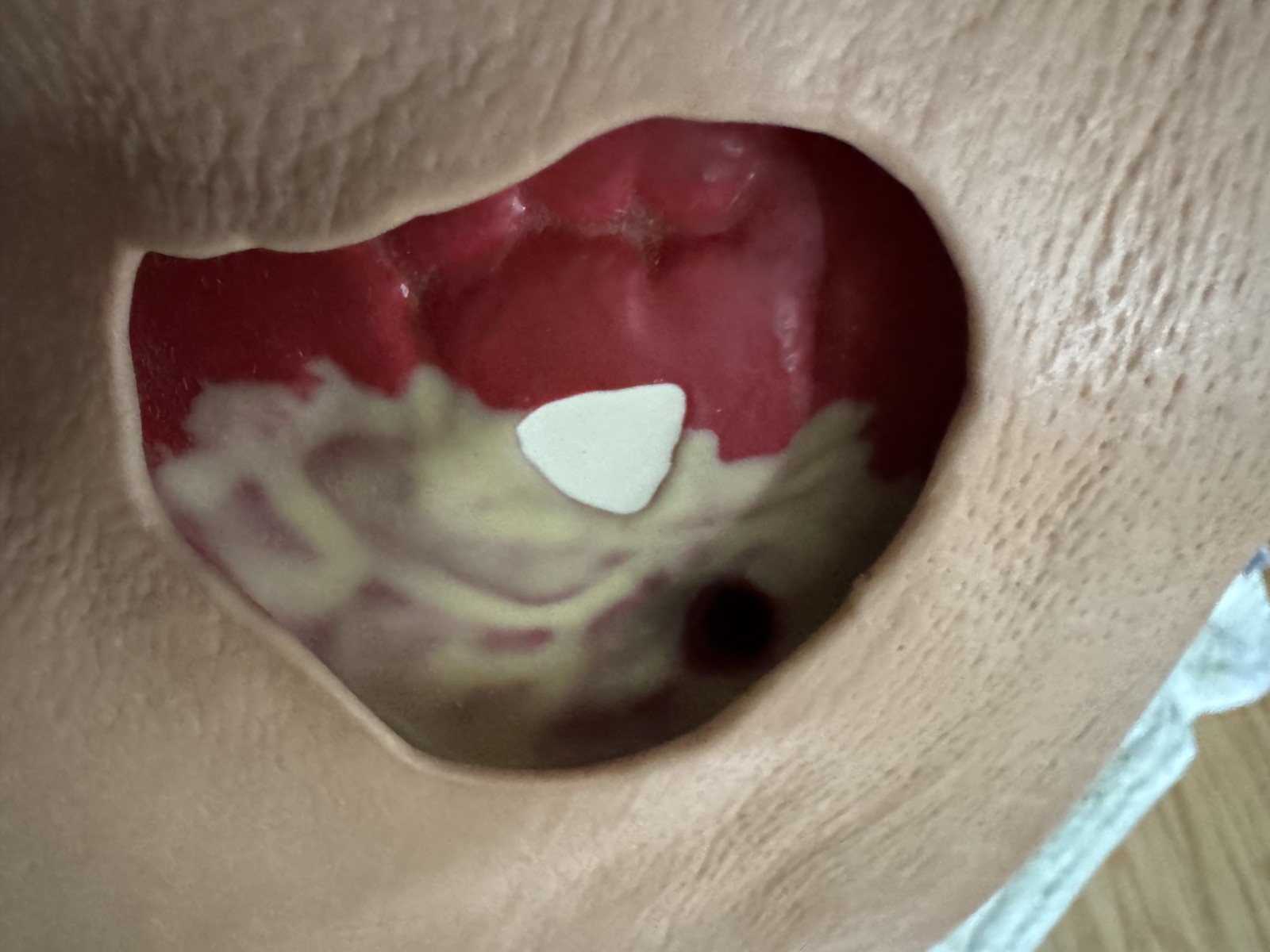 VATA Buttock Wound Care Teaching Model