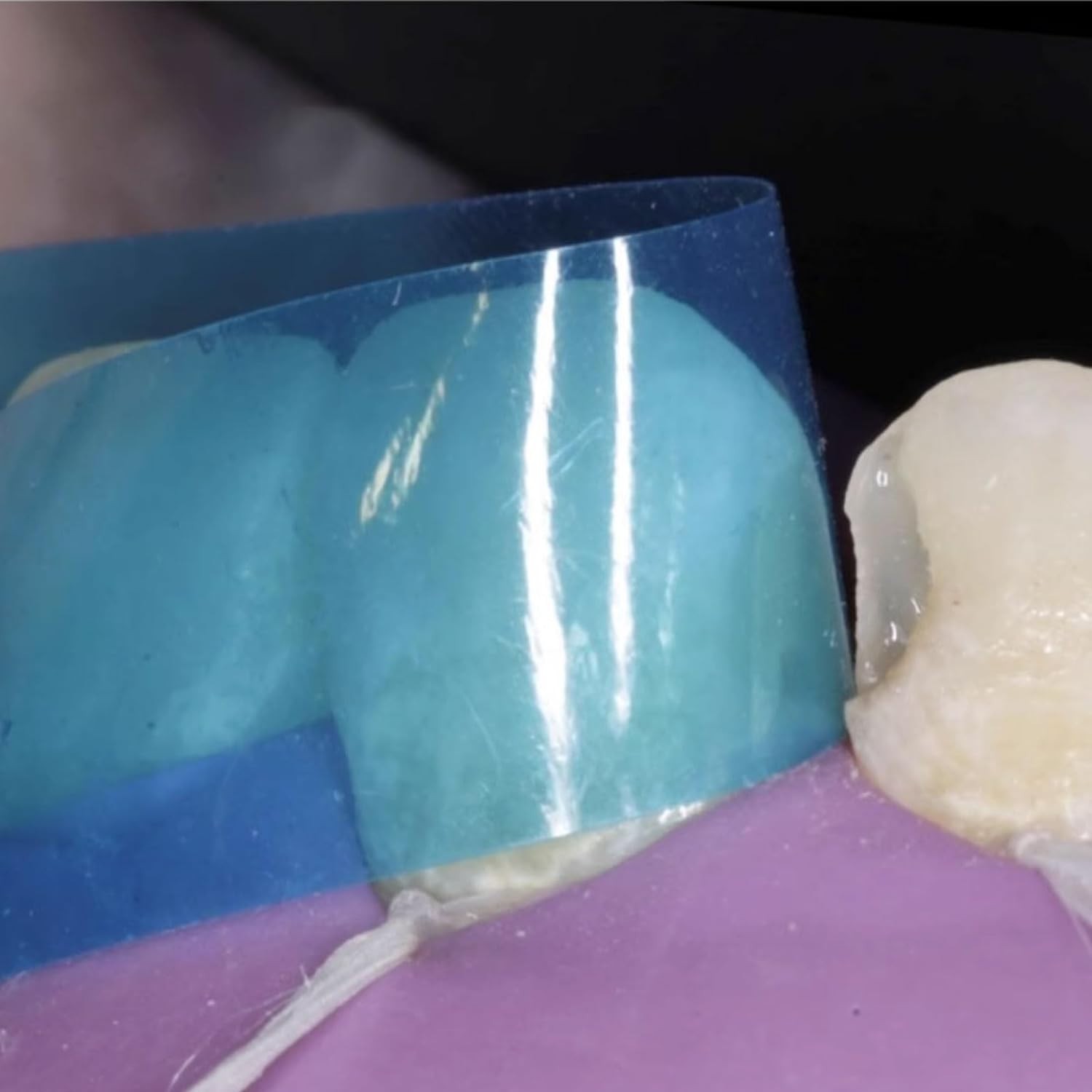 Dental Proximal Anterior Strips Polyester Matrix Bands Clear Matrices Anterior