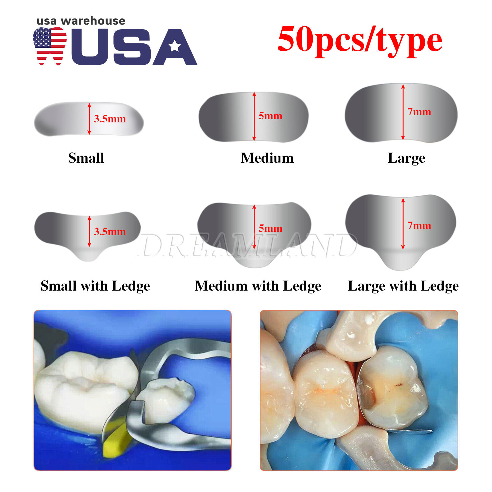 50Pcs Dental Matrices Bands Sectional Contoured Metal Matrix bands S/M/L