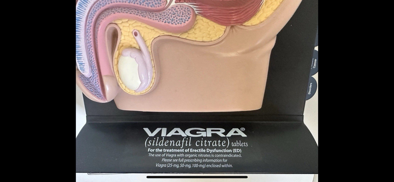 Male and Female Pelvis 2-sided 3D Anatomical Model with Info Cards 8” Tall