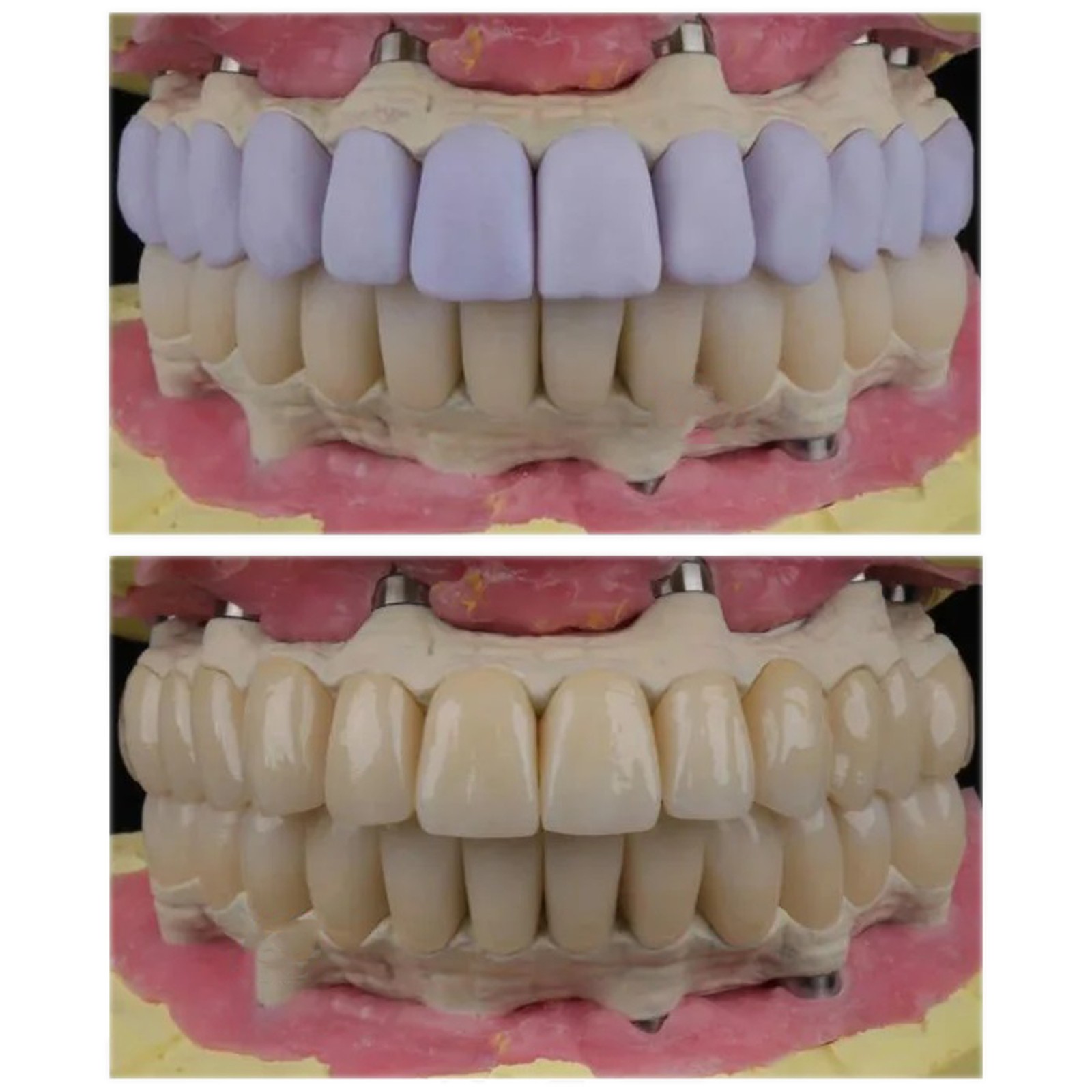 C14 Dental Lithium Disilicate Milling Blocks CEREC InLab Chairside Restorations