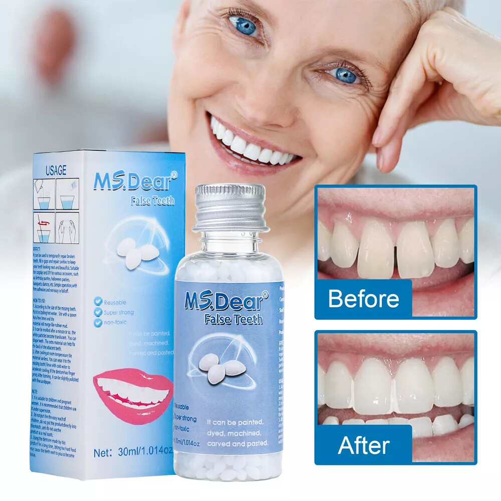 Resin False Teeth Solid Glue Temporary Tooth Repair Moldable Teeth Gap Denture