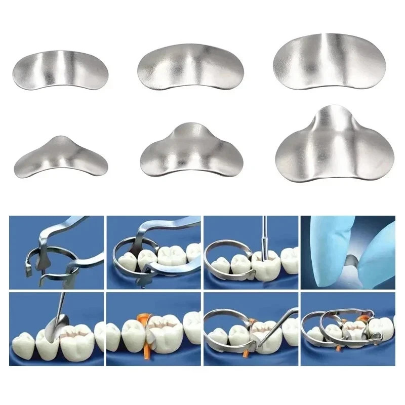 100pcs/Box Dentales Matrices Bandas de matriz de metal contorneadas se Dentista