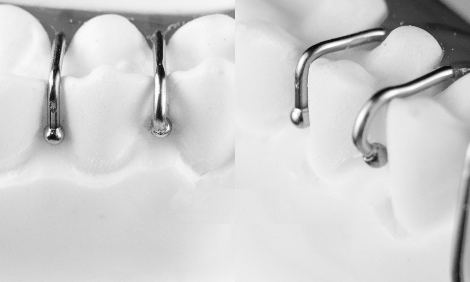 Dental Ortho Ball Retainer J Clasp Wire Oblique Clasps Bars Y-Type Scheu Style