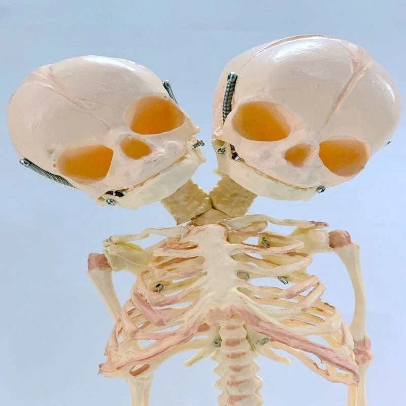 14″ Two-headed Baby Skeleton Model Fetal Model Teaching Newborn Skull Display