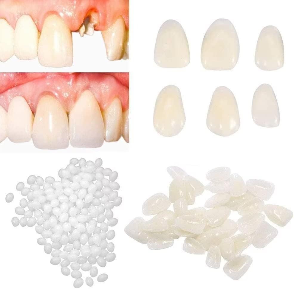 Fake Tooth Repair kits for Filling The Missing Broken and…