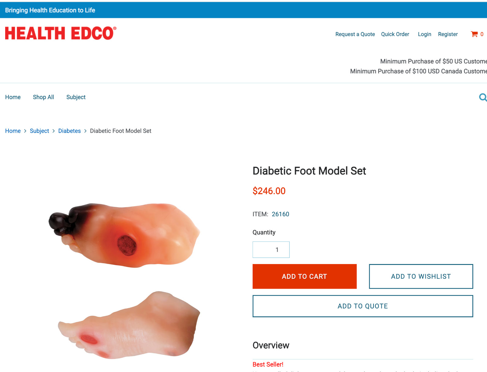 Diabetic Foot Model Set (Severe)