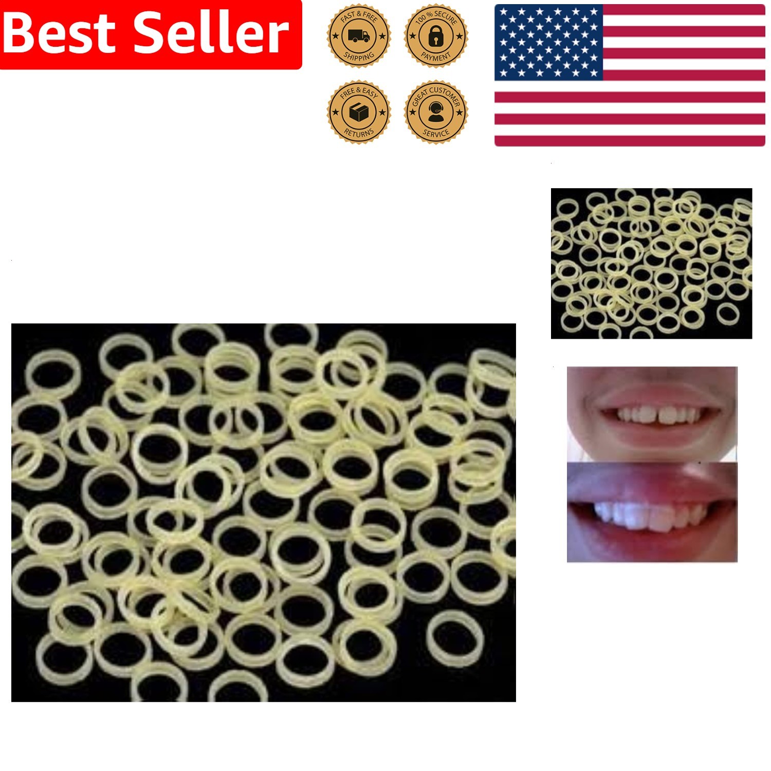 Strong 4.5 Ounce Quality 100pc Teeth Alignment