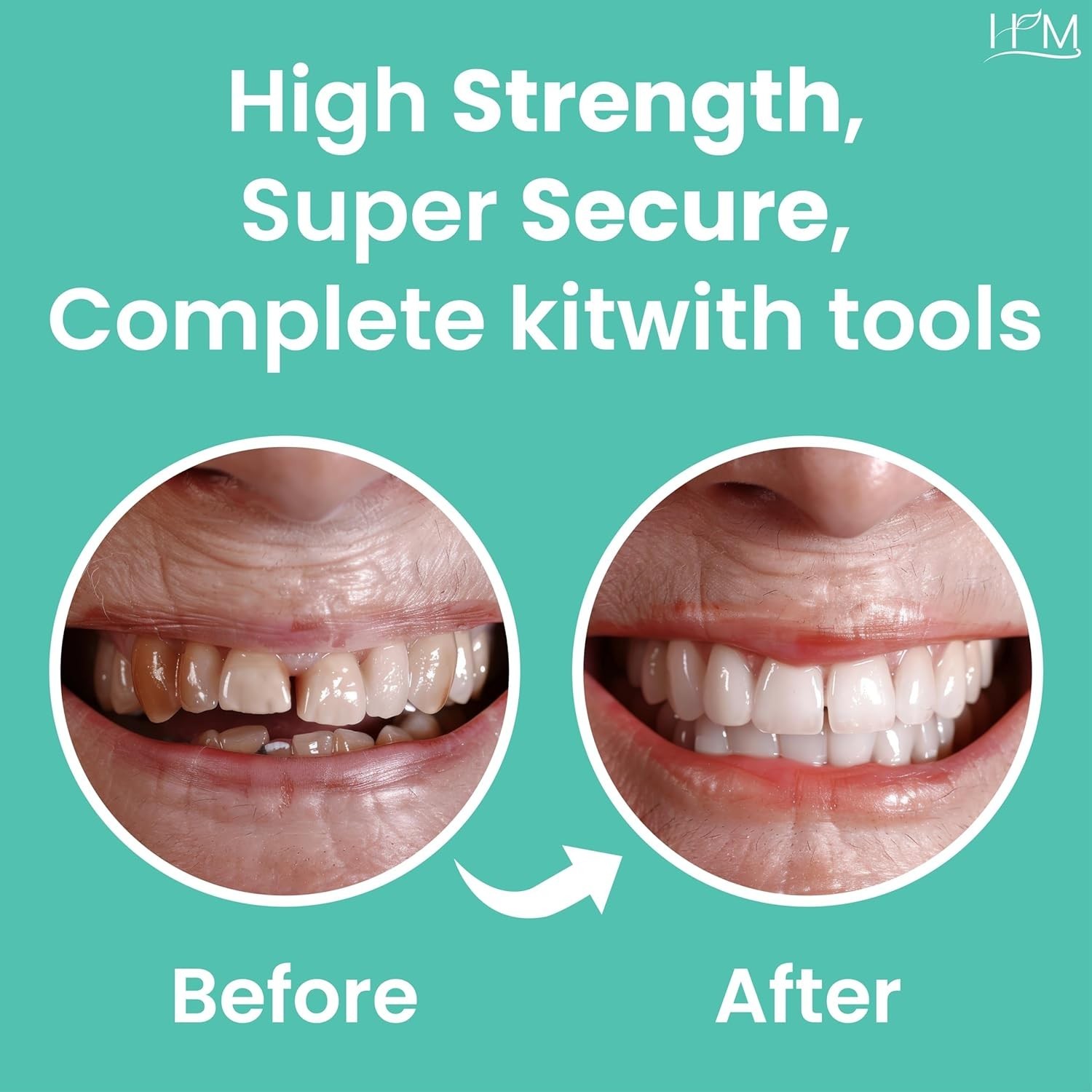 Super Adhesive Dental Cement Kit – Fast Drying, Non-Toxic Tooth Repair Solution