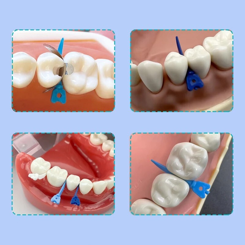 Dental Matrix Bands Ring Sectional Matrice Clamp Wedges Fit Palodent V3 System